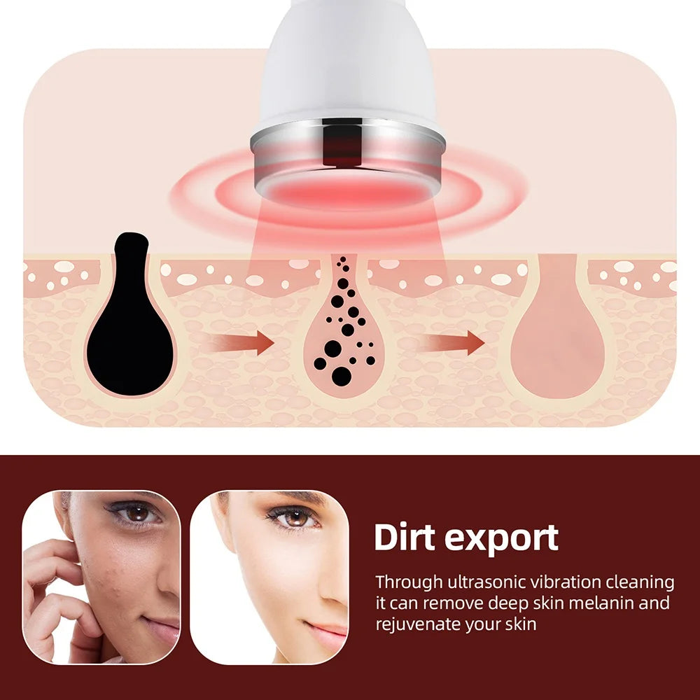 Ultrasound Skin Care Beauty Machine