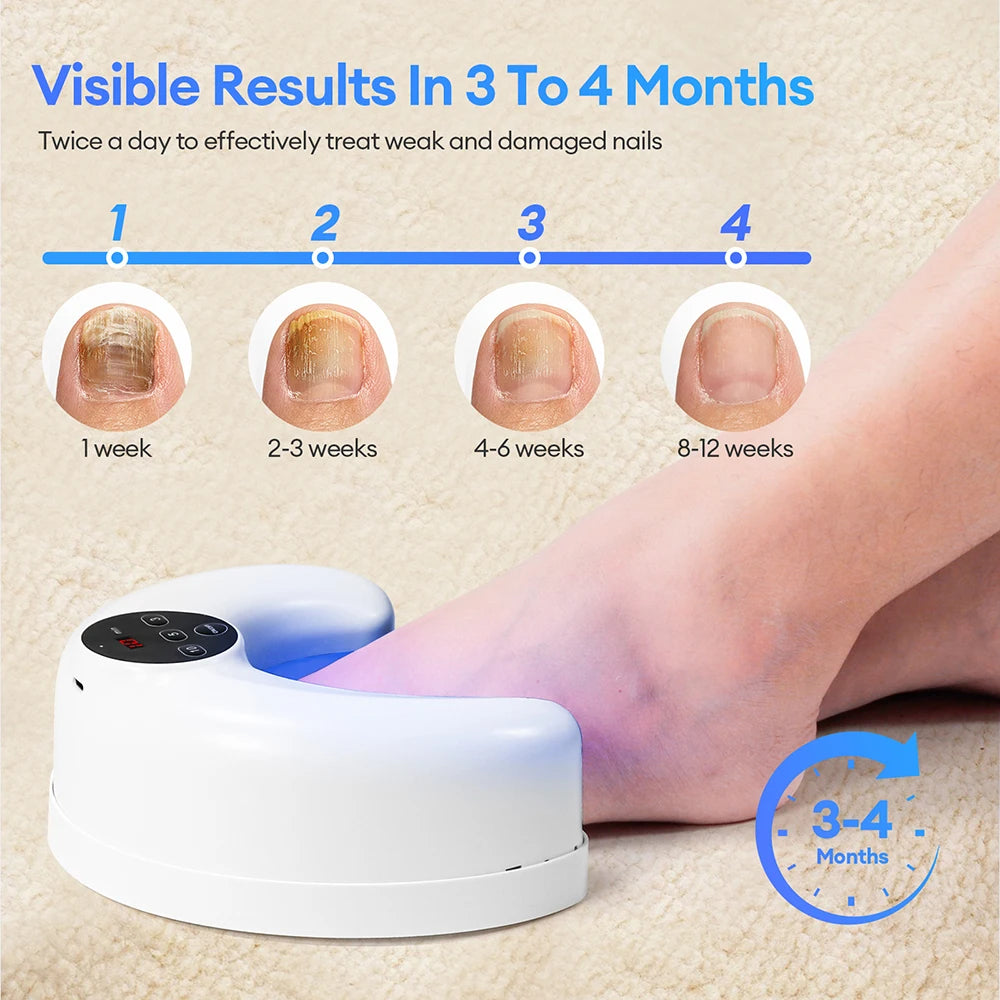 Nail Fungus Treatment Lamp