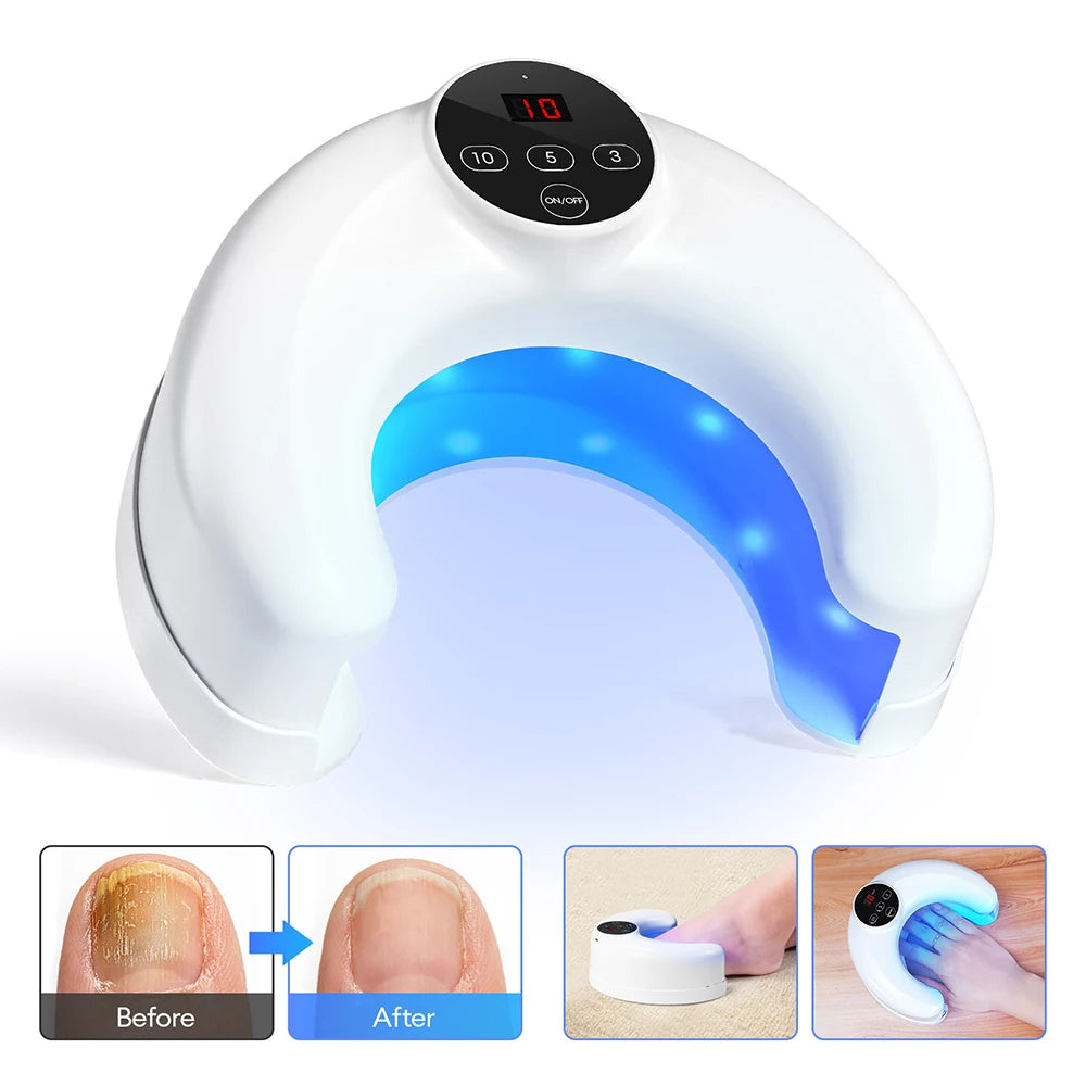 Nail Fungus Treatment Lamp