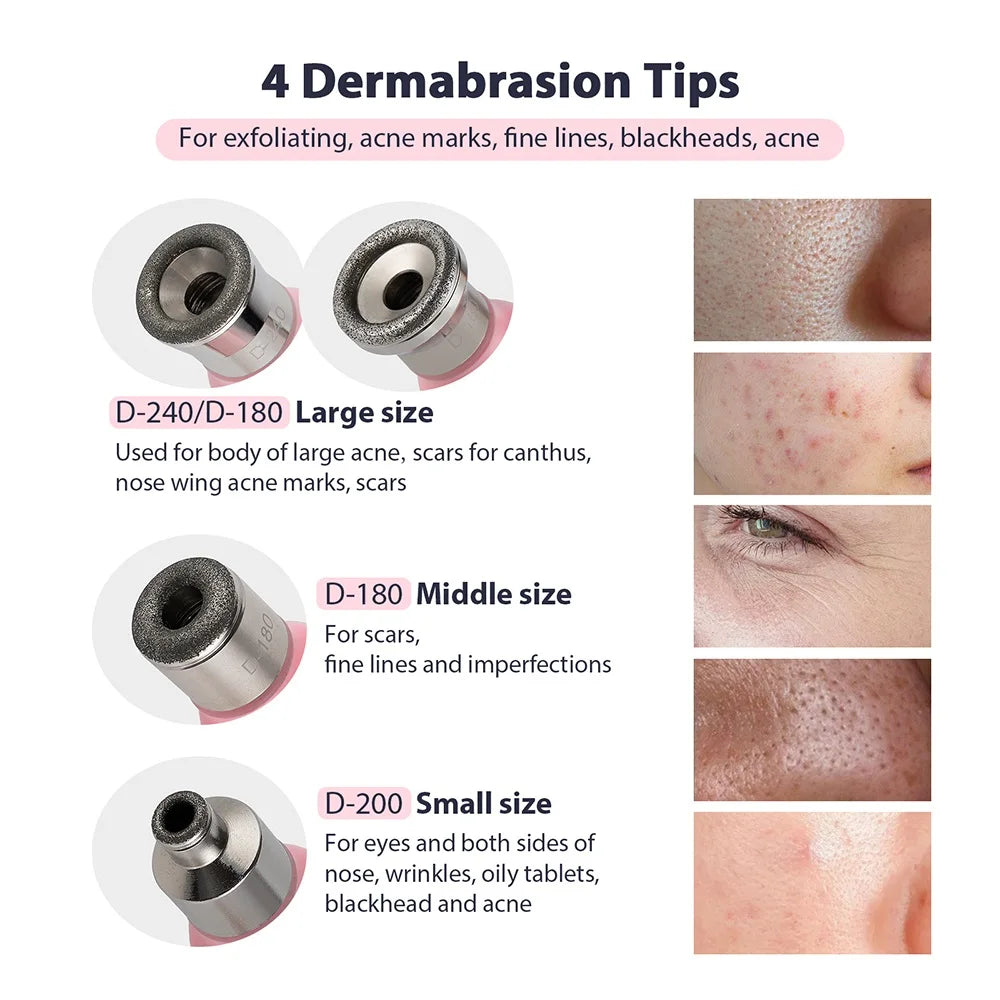 Microdermabrasion & Blackhead Remover