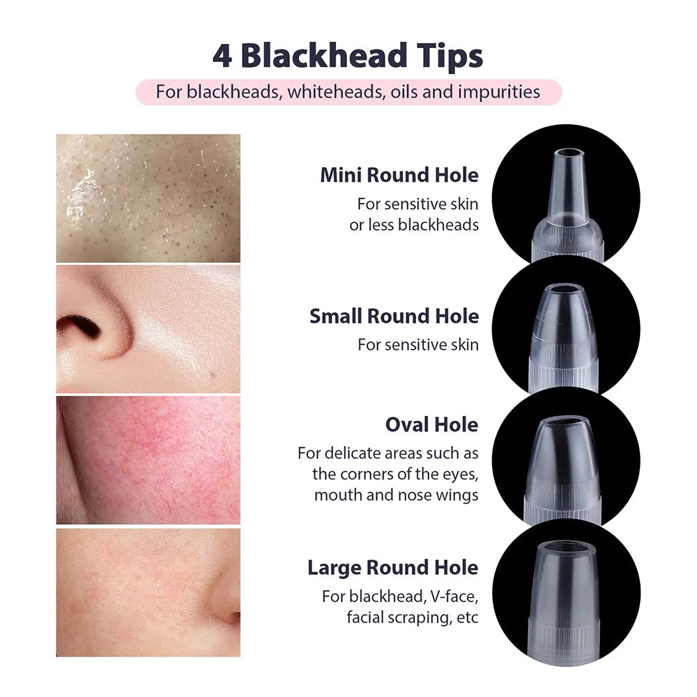 Microdermabrasion & Blackhead Remover