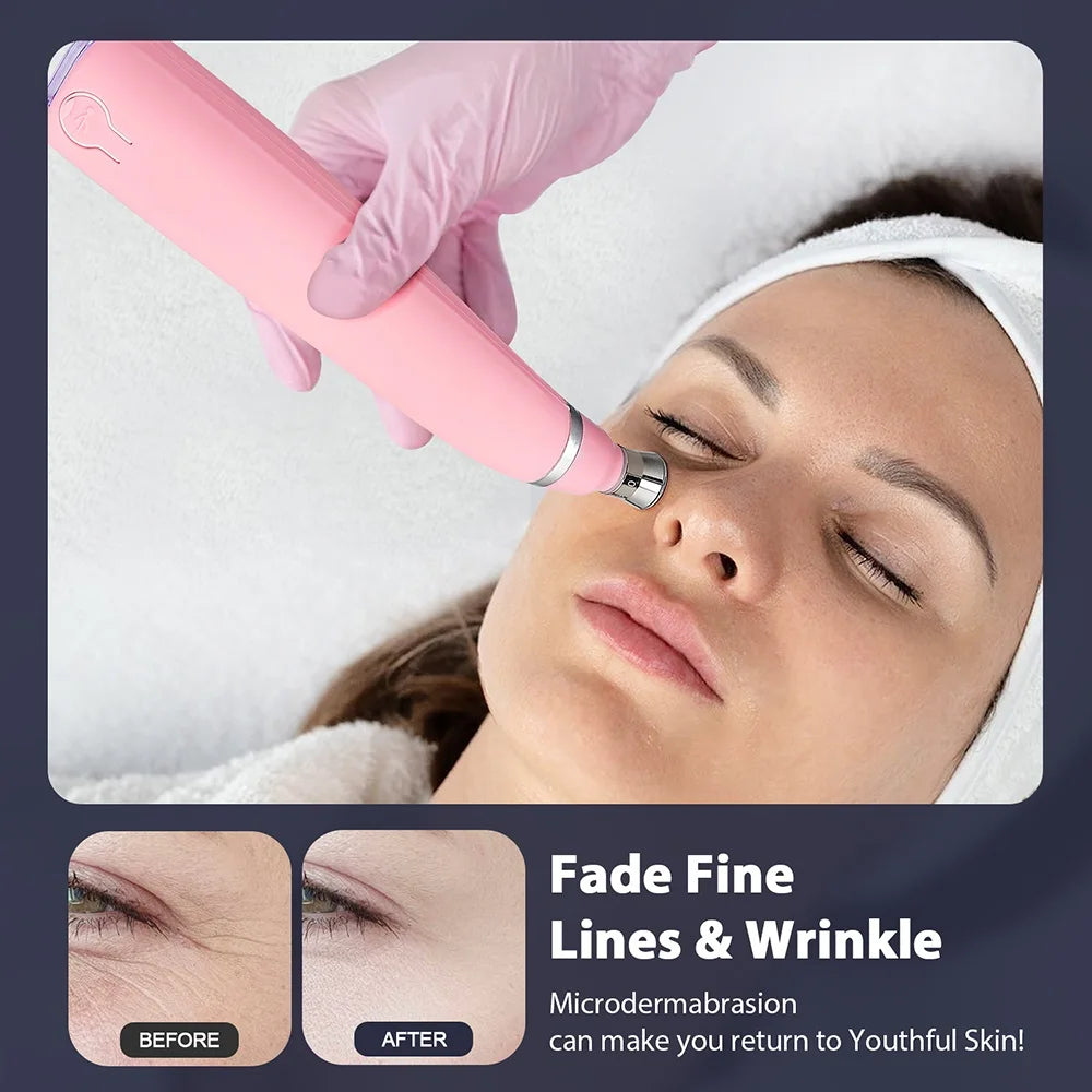 Microdermabrasion & Blackhead Remover