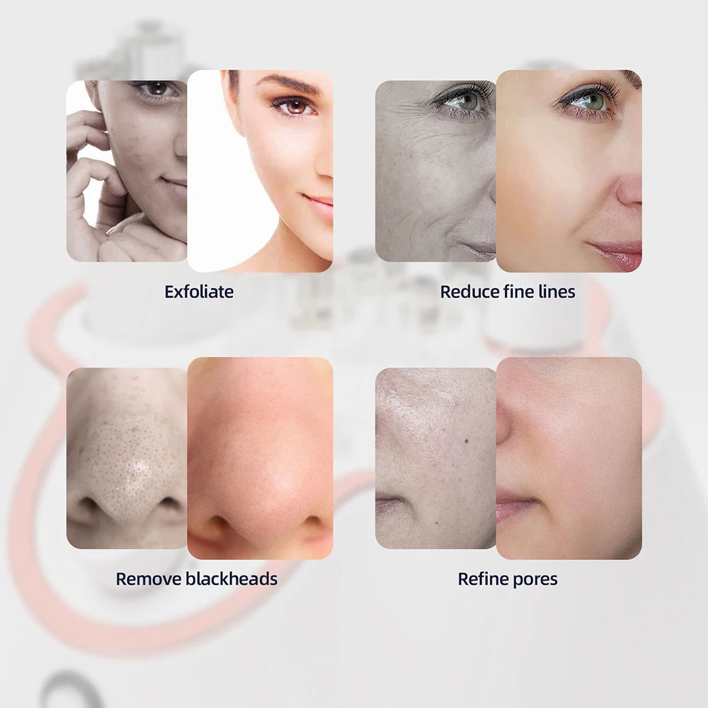 Diamond Facial Machine