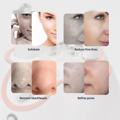 Diamond Facial Machine