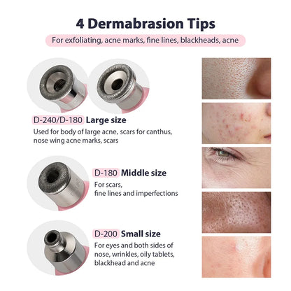 Microdermabrasion & Blackhead Remover